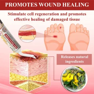 ALISANDA® GlucoseGuard Skin Rescue Cream 17 ALISANDA® GlucoseGuard Skin Rescue Cream