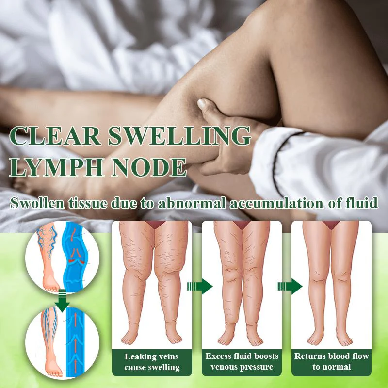 ATTDX® VeinoRoll Therapy Edema Comfort Cream 7 ATTDX® VeinoRoll Therapy Edema Comfort Cream