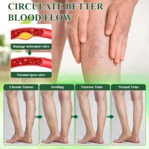 ATTDX® HerbalDrain Edema Comfort Massage Cream