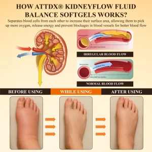 ATTDX® KidneyFlow Fluid Balance Softgels 17 ATTDX® KidneyFlow Fluid Balance Softgels