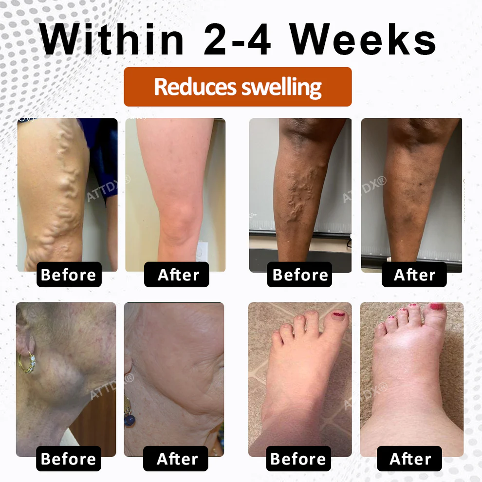 ATTDX® KidneyFlow Fluid Balance Softgels 3 ATTDX® KidneyFlow Fluid Balance Softgels