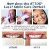 ATTDX® Laser Smile Care Device 2 ATTDX® Laser Smile Care Device
