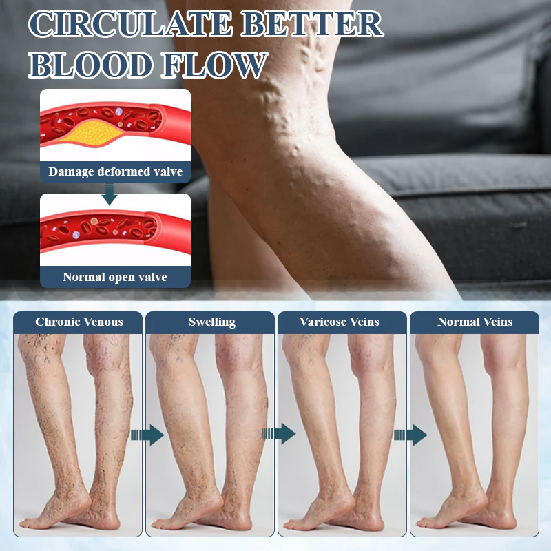 ATTDX® LymphoHerb Edema Support Capsules 8 ATTDX® LymphoHerb Edema Support Capsules