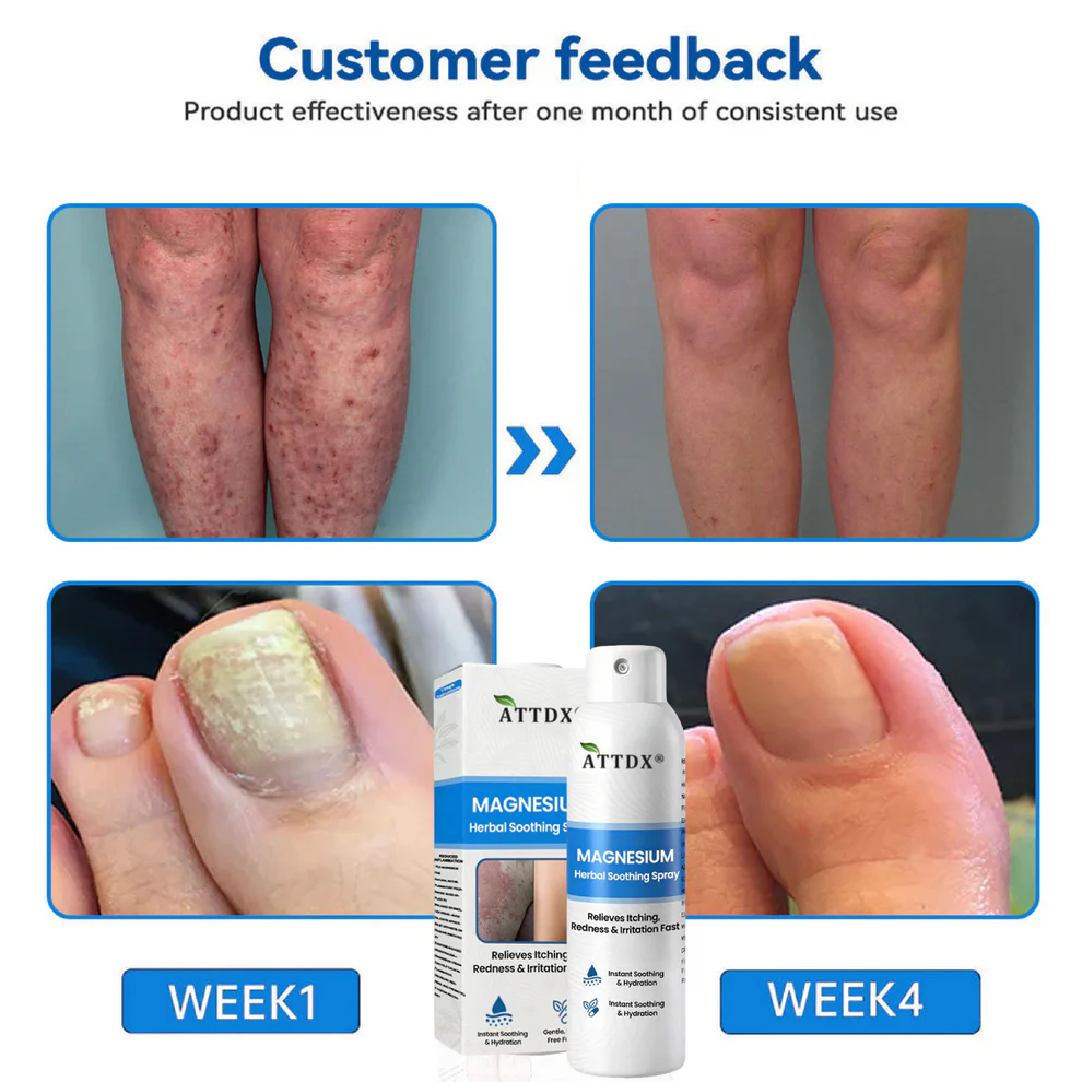 ATTDX® Magnesium Herbal Soothing Spray 12 ATTDX® Magnesium Herbal Soothing Spray