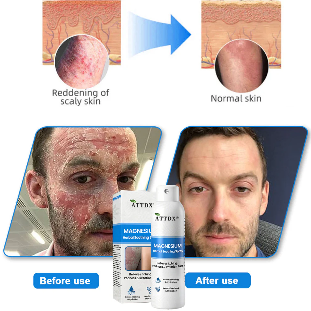 ATTDX® Magnesium Herbal Soothing Spray 13 ATTDX® Magnesium Herbal Soothing Spray