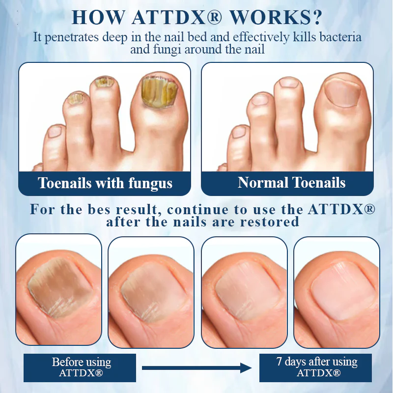 ATTDX® MycoStop Nail Recovery Serum Pen 8 ATTDX® MycoStop Nail Recovery Serum Pen