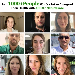 ATTDX® NatureErase Instant Alligator Oil Mole & Spot Cream 10 ATTDX® NatureErase Instant Alligator Oil Mole & Spot Cream