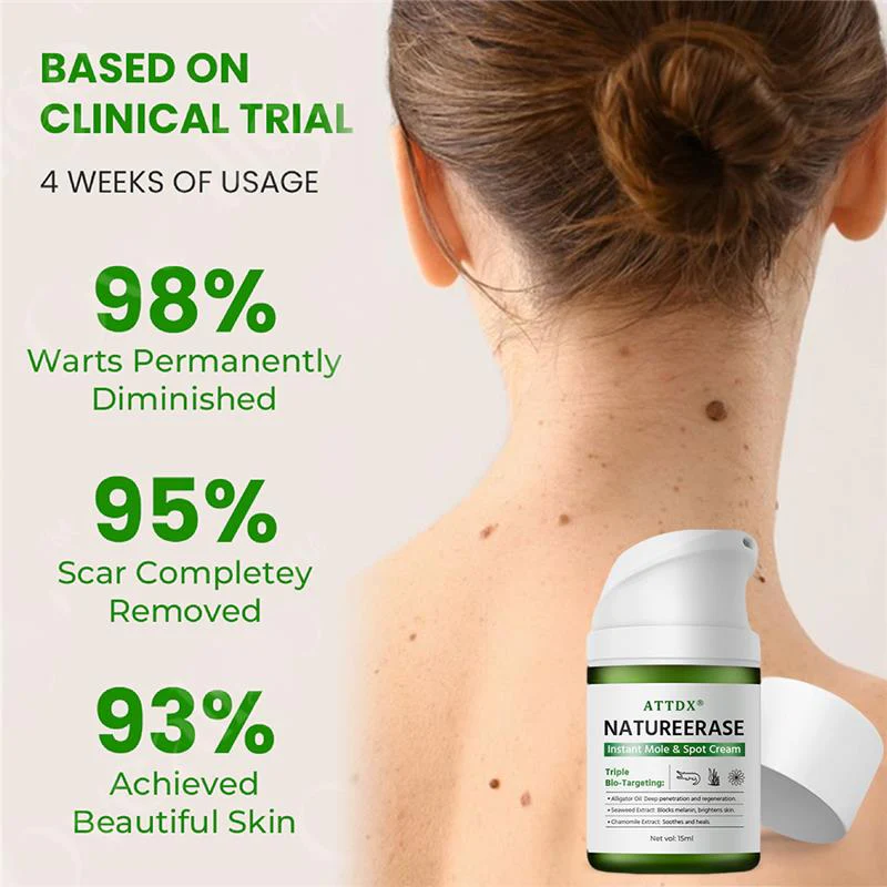 ATTDX® NatureErase Instant Alligator Oil Mole & Spot Cream 7 ATTDX® NatureErase Instant Alligator Oil Mole & Spot Cream