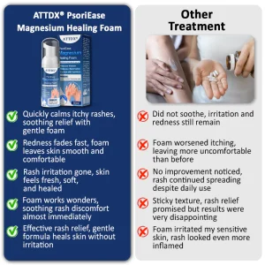 ATTDX® PsoriEase Magnesium Healing Foam 19 ATTDX® PsoriEase Magnesium Healing Foam