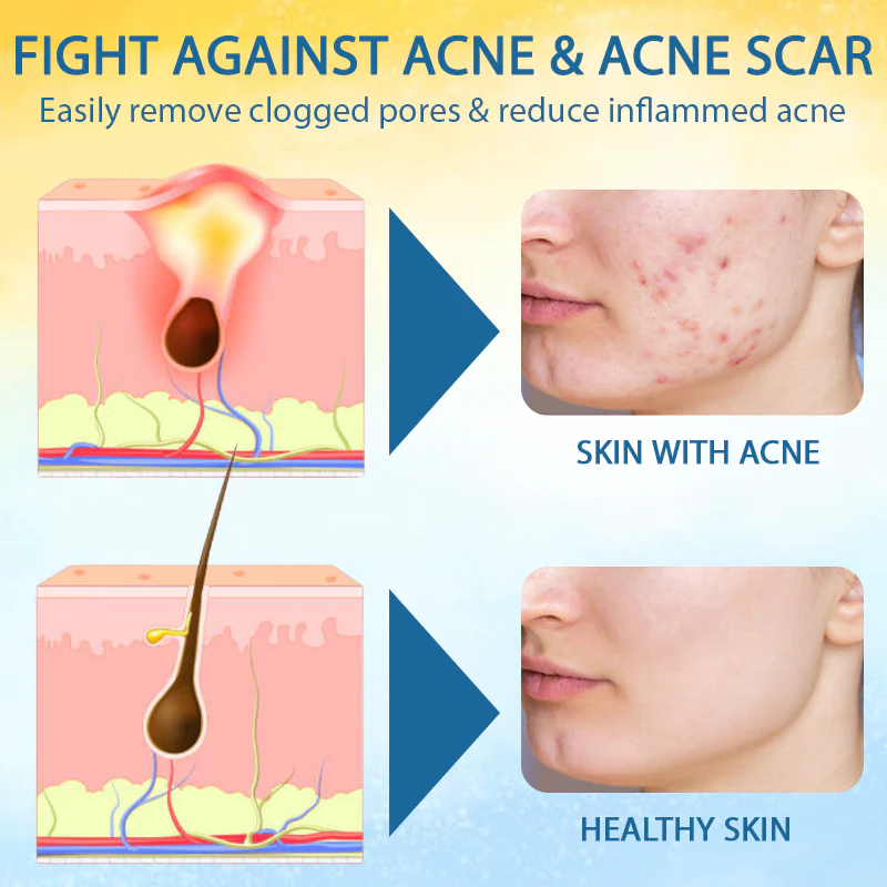 LOVILDS™ Psoriasis Care Mellifera Venom Skin Healing Spray 6 LOVILDS™ Psoriasis Care Mellifera Venom Skin Healing Spray