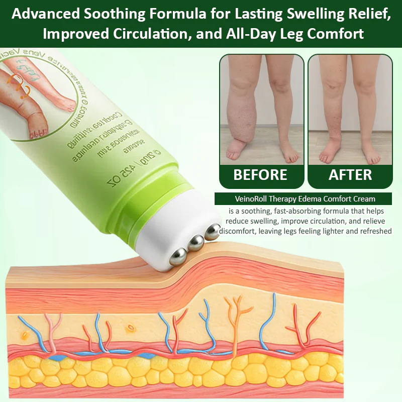 ATTDX® VeinoRoll Therapy Edema Comfort Cream 5 ATTDX® VeinoRoll Therapy Edema Comfort Cream