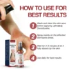 ATTDX® DermSoothe Psoriasis Relief Spray 9 ATTDX® DermSoothe Psoriasis Relief Spray