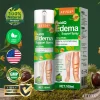 ATTDX® FluidiQ Edema Support Spray