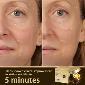 ODEIUN™ Anti-Aging Cream – Hyaluronic Acid, Retinol & Collagen for Face, Neck 16 ODEIUN™ Anti-Aging Cream – Hyaluronic Acid, Retinol & Collagen for Face, Neck