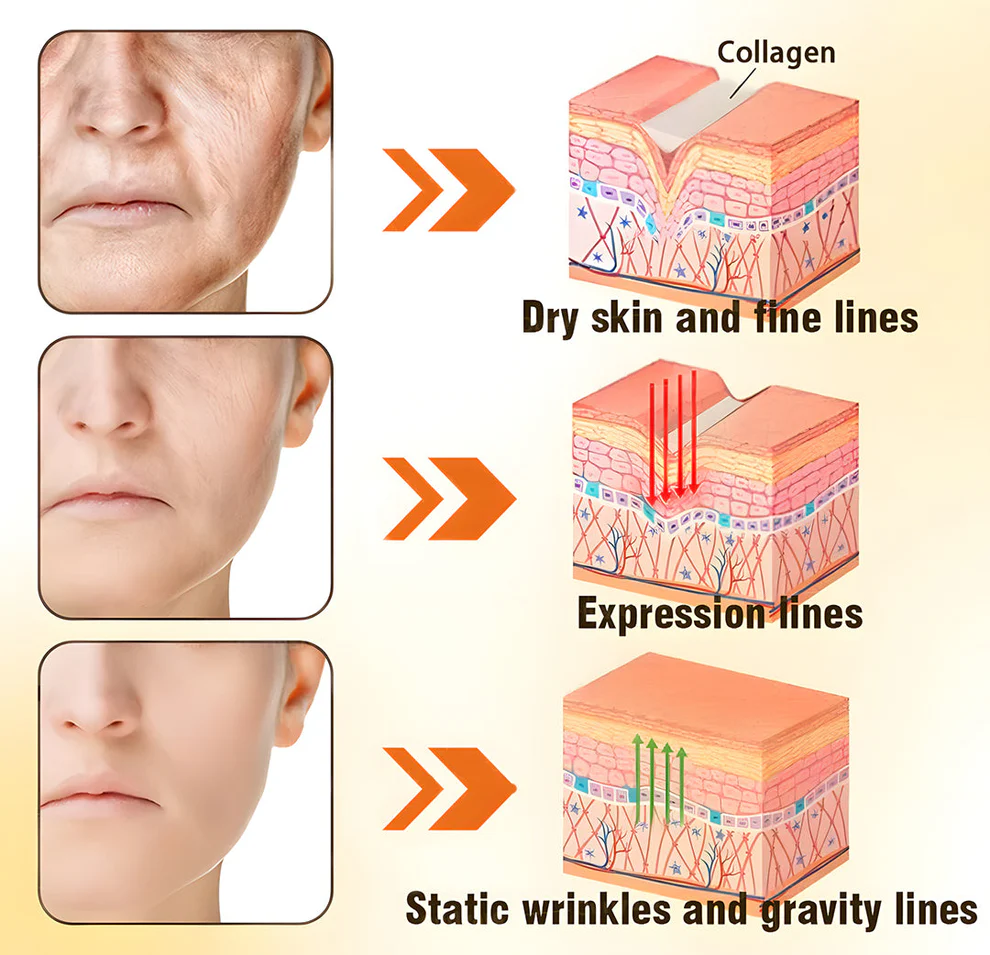 ODEIUN™ Anti-Aging Cream – Hyaluronic Acid, Retinol & Collagen for Face, Neck 10 ODEIUN™ Anti-Aging Cream – Hyaluronic Acid, Retinol & Collagen for Face, Neck