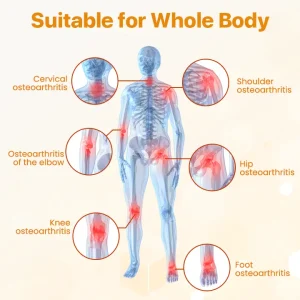 BeeTherix™ Bee Venom Joint Repair Cream 10 BeeTherix™ Bee Venom Joint Repair Cream