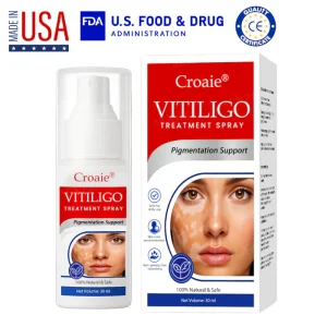 Croaie® Vitiligo Treatment Spray - No allergies