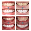 LIMETOW™ Instant Teeth Whitening Paint 9 LIMETOW™ Instant Teeth Whitening Paint