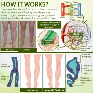 ATTDX® SwellSoothe Lymphatic Cream