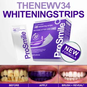 Flysmus® V34 Whitening Strips