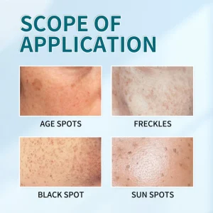 Bikenda™ Blemish Removing Beauty Cream