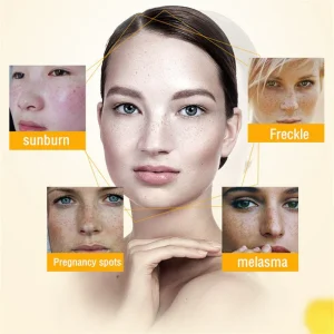 Bikenda™ Blemish Removing Beauty Cream