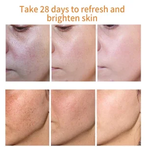 Bikenda™ Blemish Removing Beauty Cream