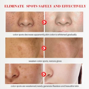 Bikenda™ Blemish Removing Beauty Cream