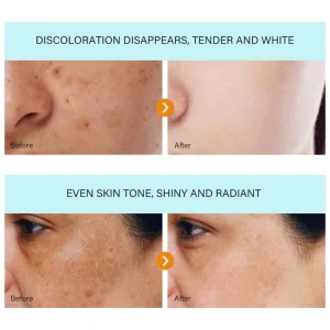 Bikenda™ Blemish Removing Beauty Cream