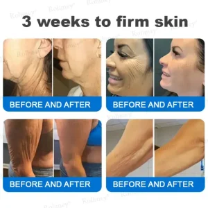 Rolimey® Advanced Firming & Wrinkle-Reducing Cream 15 Rolimey® Advanced Firming & Wrinkle-Reducing Cream