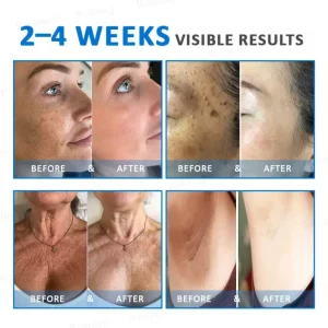 Rolimey® Advanced Firming & Wrinkle-Reducing Cream 17 Rolimey® Advanced Firming & Wrinkle-Reducing Cream