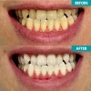 LIMETOW™ Instant Teeth Whitening Paint 10 LIMETOW™ Instant Teeth Whitening Paint