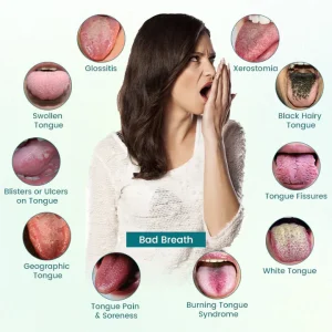 ATTDX® GlosShield Tongue Repair Spray