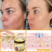 Laozik™ Skin Restoration Cream 3 Laozik™ Skin Restoration Cream - Image 3