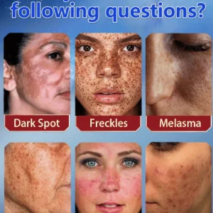 Bikenda™ Blemish Removing Beauty Cream