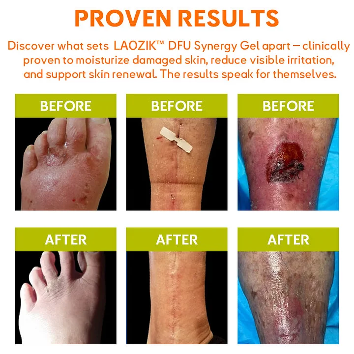 LAOZIK™ DFU Synergy Gel 9 LAOZIK™ DFU Synergy Gel