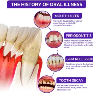 Rolimey® VioCore Bee Venom Dental Treatment Toothpaste 15 Rolimey® VioCore Bee Venom Dental Treatment Toothpaste