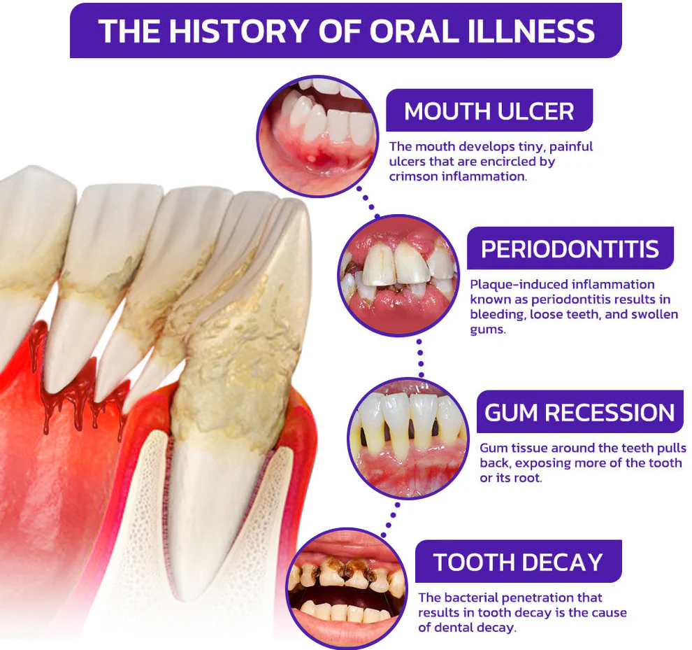 Rolimey® VioCore Bee Venom Dental Treatment Toothpaste 6 Rolimey® VioCore Bee Venom Dental Treatment Toothpaste