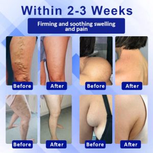 Elycura™ Lymphatic Drainage Massage Cream 8 Elycura™ Lymphatic Drainage Massage Cream